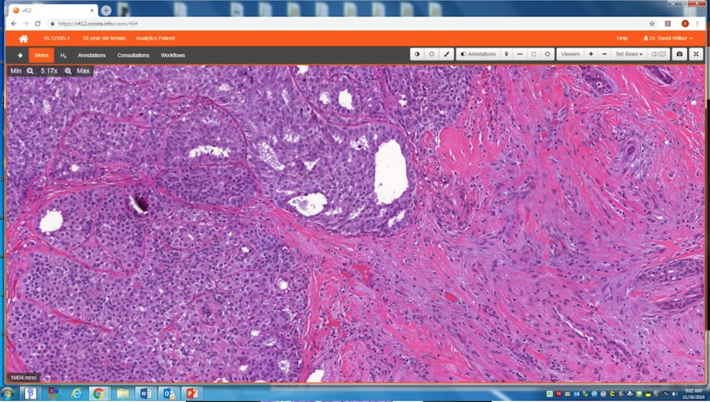 digital pathology