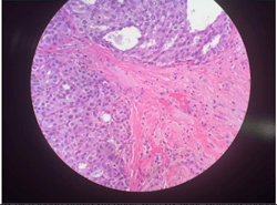 digital pathology