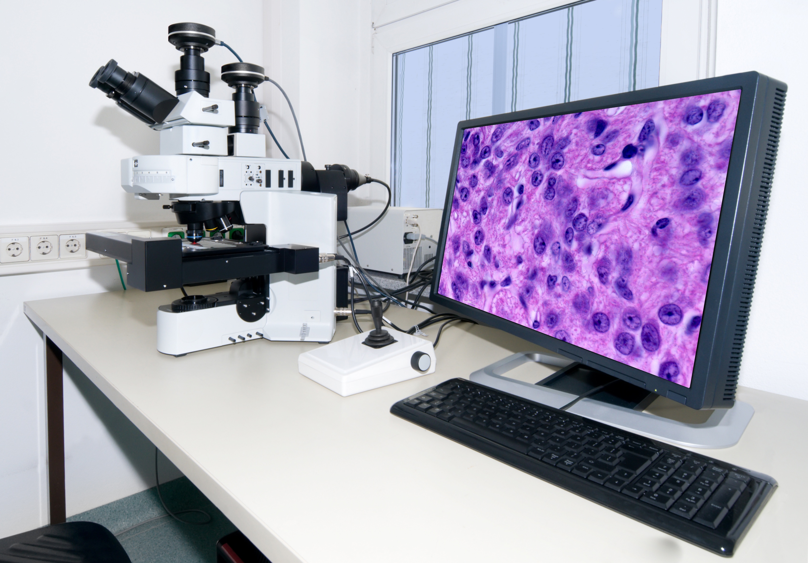 Digital Pathology Blog digital pathology